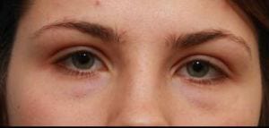 Close-up of a woman's eyes and eyebrows, showing details of her skin, eyes, and partial nose bridge.
