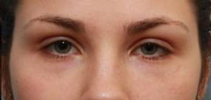 Close-up of a woman's eyes and the bridge of her nose, showing light skin, dark eyebrows, and green eyes looking directly at the viewer.