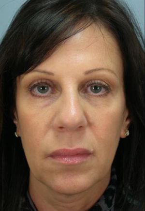 Close-up frontal portrait of a woman with shoulder-length dark hair, wearing a black blouse. she has a neutral expression and is looking directly at the camera.