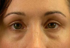 Close-up of a woman's eyes looking directly at the camera, showing brown irises and a calm expression.