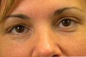 Close-up image focusing on a woman's eyes and the bridge of her nose, highlighting her brown eyes and fair skin.