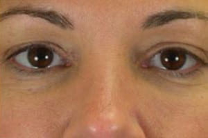 Close-up view of a woman's face focusing on her eyes and the bridge of her nose, showing her brown eyes and slight under-eye shadows.