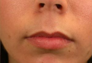 Close-up of a person's lower face, showing the nose and lips. the lips are wearing red lipstick and the skin is clear with visible pores on the nose.