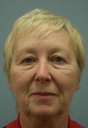 Portrait of an elderly woman with short blond hair, wearing a red shirt, facing the camera with a neutral expression.