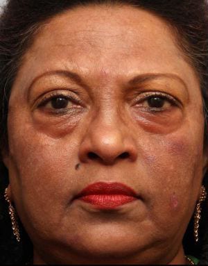 Close-up of a middle-aged woman with tan skin, wearing red lipstick and gold earrings, showing a serious expression. she has visible signs of aging and dark circles under her eyes.