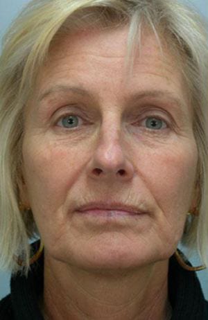 Close-up frontal portrait of a middle-aged caucasian woman with blonde hair, looking directly at the camera, neutral expression. she wears small hoop earrings and a black top.