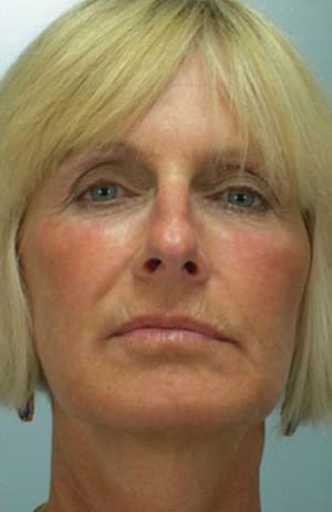 Headshot of a middle-aged caucasian woman with straight blonde bob hair, no visible makeup, and small earrings, looking directly at the camera with a neutral expression.