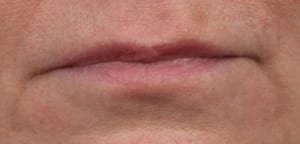Close-up image of a person's closed mouth, showing lips with a natural tone and slight texture differences, focusing on facial details without additional context.