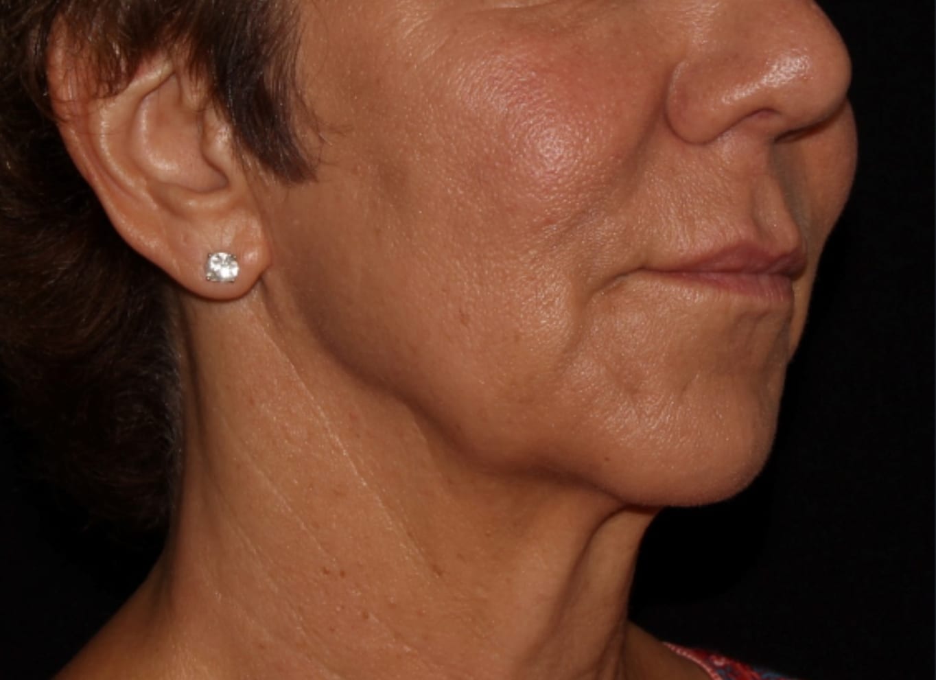 Close-up side view of a woman with tanned skin, showing her ear with a diamond earring, and visible wrinkles on her neck and cheek.
