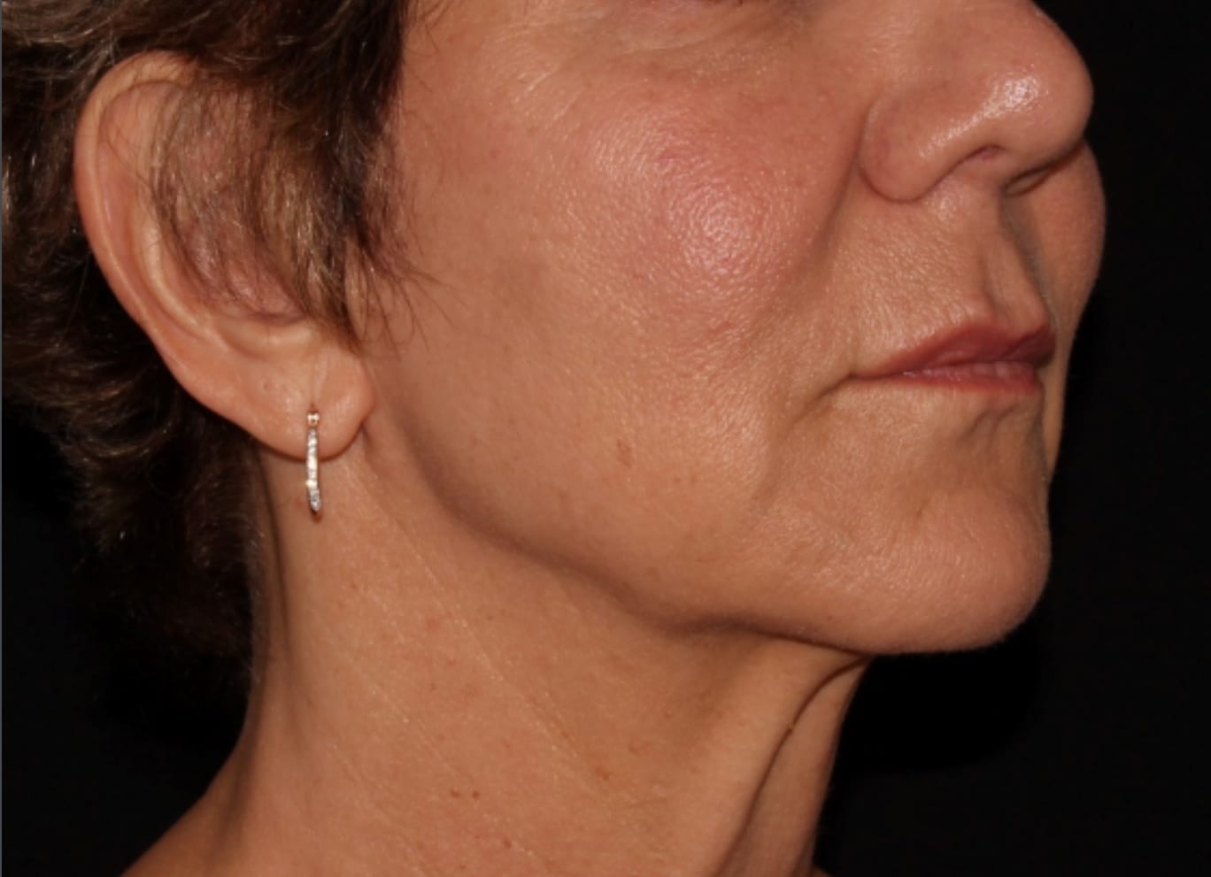 Side profile of a woman with fair skin wearing a silver drop earring, set against a dark background. her expression is neutral and her eyes are not visible in the frame.