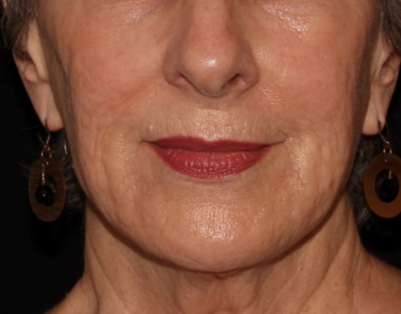 Close-up of an older woman's lower face, showing her lips, chin, and nose, wearing red lipstick and round earrings. her skin appears smooth with natural signs of aging.