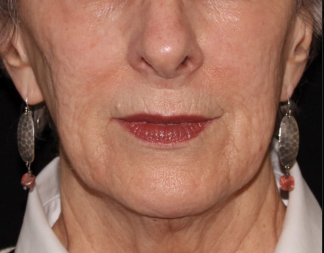 Close-up of an elderly woman's lower face, showing her lips slightly parted and wearing large, oval-patterned earrings with pink gem accents.