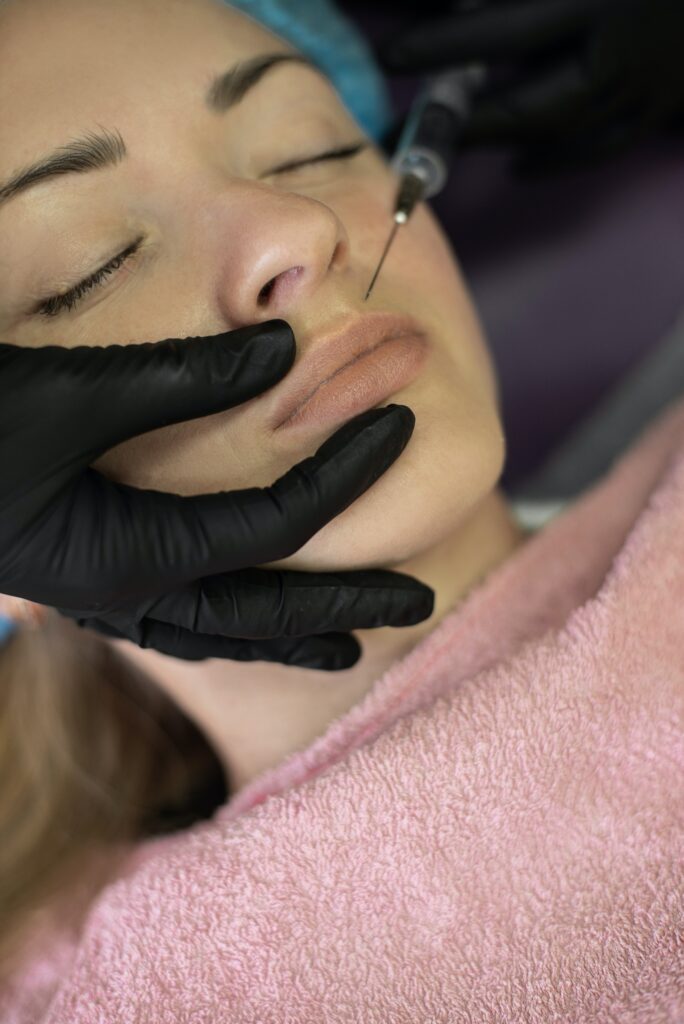 Woman receiving botulinum toxin injection above the mouth