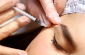 medical professional injecting Botox into the crows feet around an adult woman’s eyes