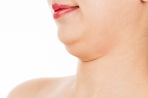 Close up of a woman with a double chin
